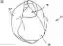 Fig. 01 - Baby wrap and method of use