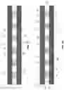 Fig. 08 - Multilayer fabric with selective radiation filter