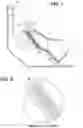 Fig. 02 - HEATING DEVICE