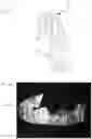 Fig. 45 - UNIBODY CONSTRUCTION FOOTWEAR AND METHOD FOR MAKING THE SAME