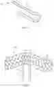Fig. 07 - Watch band with braided strands