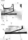 Fig. 06 - Rocker chair