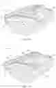 Fig. 08 - CPAP PILLOW APPARATUS AND METHOD