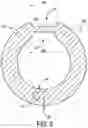 Fig. 04 - DETACHABLE STRAW