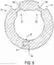 Fig. 06 - DETACHABLE STRAW