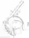 Fig. 07 - Blood pressure measuring device