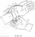 Fig. 16 - Blood pressure measurement device
