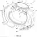 Fig. 03 - Blood pressure measuring device