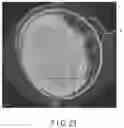Fig. 23 - Blood pressure measuring device