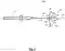 Fig. 03 - Device, system and use of a catheter system to record and map cardiac rhythm