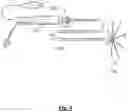 Fig. 05 - Device, system and use of a catheter system to record and map cardiac rhythm