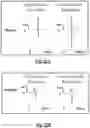 Fig. 23 - Device, system and use of a catheter system to record and map cardiac rhythm