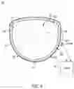 Fig. 06 - Breast-measuring device