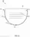 Fig. 10 - Breast-measuring device