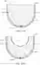 Fig. 13 - Breast-measuring device