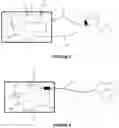 Fig. 04 - System and method for detecting an endo-urethral device for an artificial sphincter that is implantable in an animal or human body