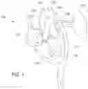 Fig. 02 - Automated condition screening and detection