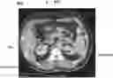 Fig. 01 - Systems and methods for limited view imaging