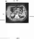 Fig. 09 - Systems and methods for limited view imaging