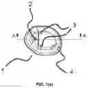 Fig. 02 - Surgical access retractor