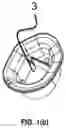 Fig. 03 - Surgical access retractor