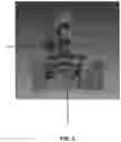 Fig. 08 - Surgical access retractor