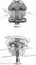 Fig. 07 - Devices for vascular occlusion