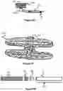 Fig. 33 - Devices for vascular occlusion