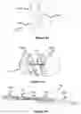Fig. 35 - Devices for vascular occlusion