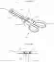 Fig. 14 - SYSTEM FOR OCCLUSION OF LEFT ATRIAL APPENDAGE