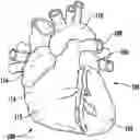 Fig. 01 - Methods, compositions, and devices for the occlusion of cavities and passageways