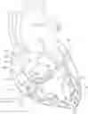 Fig. 01 - Operating a vessel occlusion catheter