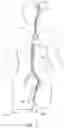 Fig. 02 - System and methods for embolized occlusion of neurovascular aneurysms