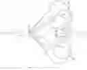 Fig. 01 - Obstruction retrieval devices