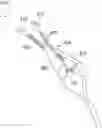 Fig. 01 - HYALINE CARTILAGE SHAPING