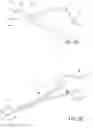 Fig. 08 - HYALINE CARTILAGE SHAPING