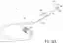 Fig. 28 - HYALINE CARTILAGE SHAPING