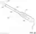 Fig. 40 - HYALINE CARTILAGE SHAPING