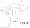Fig. 49 - HYALINE CARTILAGE SHAPING