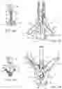 Fig. 07 - Methods and devices for tissue grasping and assessment