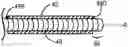 Fig. 01 - Drive shaft with metallic inner layer and polymer jacket