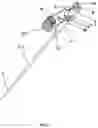 Fig. 02 - ENDOSCOPIC CANNULA