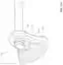 Fig. 35 - Method and apparatus for minimally invasive insertion of intervertebral implants