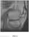 Fig. 28 - System and method for image segmentation, bone model generation and modification, and surgical planning