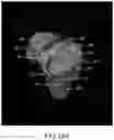 Fig. 40 - System and method for image segmentation, bone model generation and modification, and surgical planning