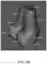 Fig. 41 - System and method for image segmentation, bone model generation and modification, and surgical planning
