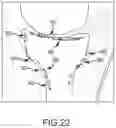 Fig. 48 - System and method for image segmentation, bone model generation and modification, and surgical planning