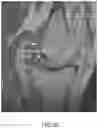Fig. 52 - System and method for image segmentation, bone model generation and modification, and surgical planning