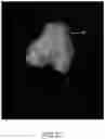 Fig. 53 - System and method for image segmentation, bone model generation and modification, and surgical planning