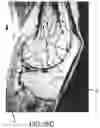 Fig. 64 - System and method for image segmentation, bone model generation and modification, and surgical planning